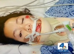 A photo of Kim Nguyen's injuries via NBC LA.