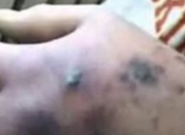 Krokodil users have been found in the St. Catharines and Niagara Region, police and health workers say.