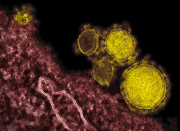 This undated electron microscope image made available by the National Institute of Allergy and Infectious Diseases - Rocky Mountain Laboratories shows novel coronavirus particles, also known as the MERS virus, colorized in yellow. (AP Photo/NIAID - RML)