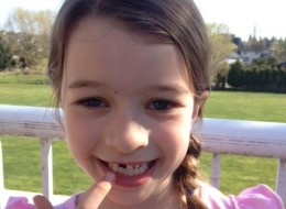 Avery Patchett lost her tooth after falling at recess.