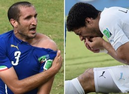 Luis Suárez está en el ojo del huracán por sus mordidas a los rivales