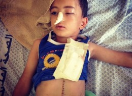 Nour, 5, descansa numa cama no Hospital al-Shifa, em Gaza. Seu pai e sua mãe foram mortos nesta semana na ofensiva israelense na terça-feira, de acordo com sua avó.