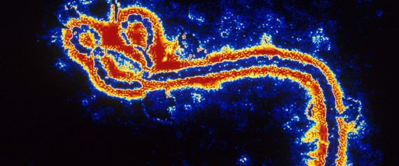 EBOLA VIRUS