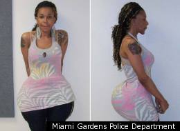Oneal Ron Morris is accused of posing as a doctor and botching butt enhancement surgeries, according to Florida health officials.