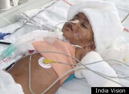 Baby Falak died on Thursday at Delhi's AIIMS Hospital