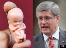 Prime Minister Stephen Harper says he'll vote against a motion introduced by one of his MPs that has reignited the national abortion debate. (CP)