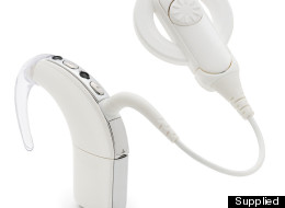 cochlear implant innovation