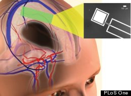 Image Credit: Meninges and Vascular Anatomy courtesy of the Central Nervous System Visual Perspectives Project, Karolinska Institutet and Stanford University.