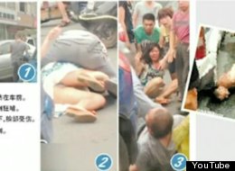 A woman was allegedly attacked in Wenzhou, China on Tuesday by a drunken bus driver who chewed off part of her face.