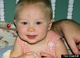 Drake Oakhill, now age 10, had the tip of his right index finger severed by the closing mechanism of a Maclaren stroller when he was three years old.