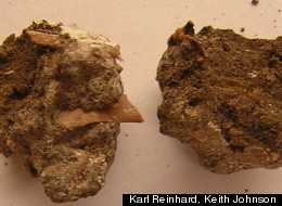 New research on fossilized feces has linked a high-fiber diet to Native Americans' susceptibility to diabetes.