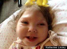 Without Medicaid, Anabelle Linzey, 2, wouldn't be able to live at home with her parents and sister, said her mother Katherine: