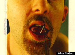 Bryan Saunders sewing his mouth