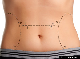 Shutterstock